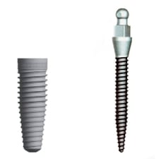 Diagram of a standard implant next to a mini implant, which are both available from Los Angles dentist Dr. Robert Thein.