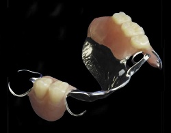 partial denture implant los angeles