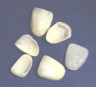Photo of six different sizes and ahdes of porcelain veneers, which are available from Glendale cosmetic dentist Dr. Robert Thein.