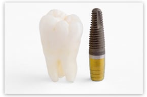 No bone dental implant placement