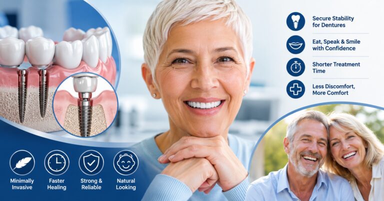 Why More Patients Are Choosing Mini Dental Implants for Smile Restoration