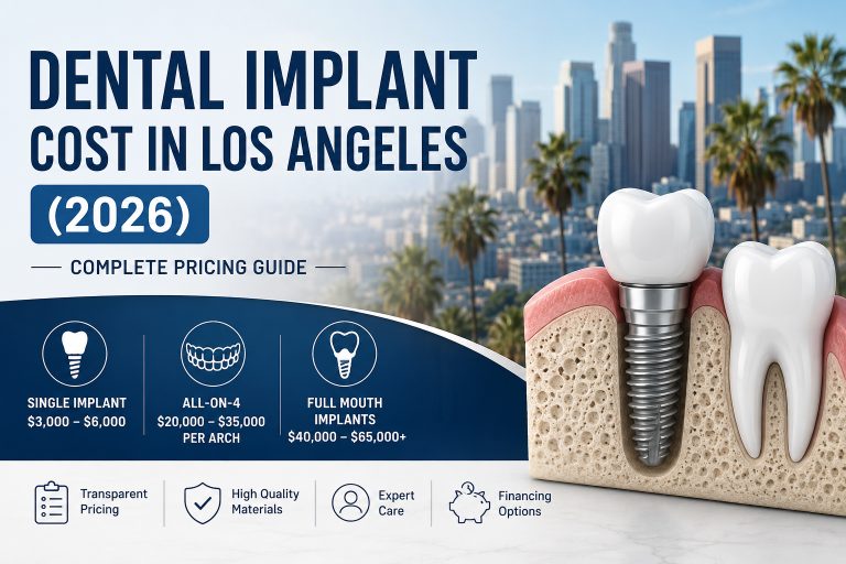Dental Implant Cost in Los Angeles (2026): Complete Pricing Guide